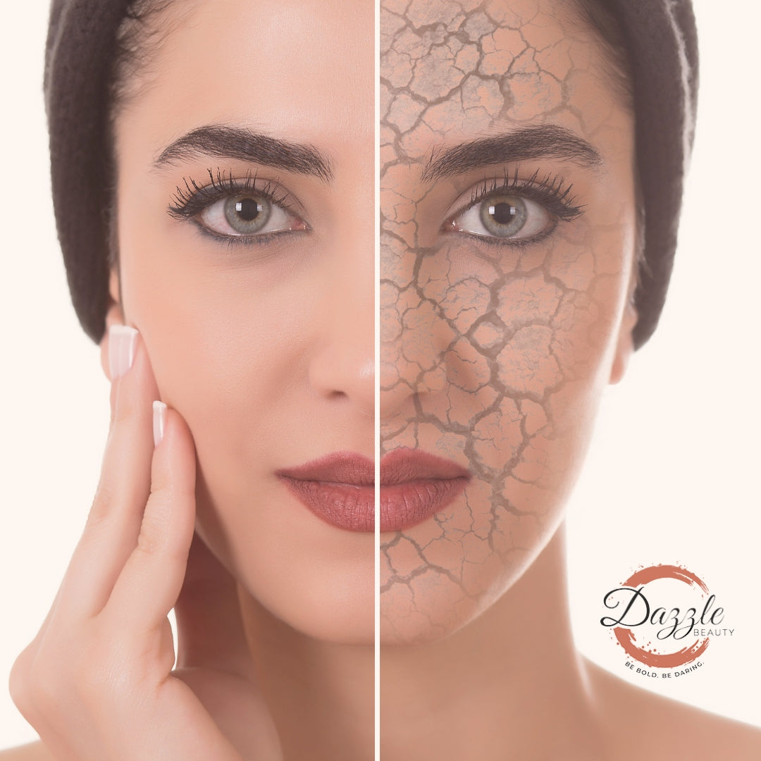 Demystifying Dry Skin !! Demystifying Dry Skin !!